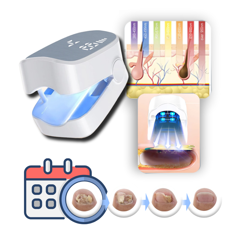 Laser Therapy, Pain-Free For Nail Fungus